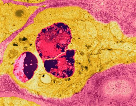  Kryptosporidium! Un Ospite Inaspettato Con un Gusto per l'Intestino