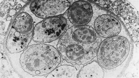  Toxoplasma gondii: Un parassita astuto che manipola le sue prede per raggiungere la sua destinazione finale!